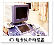 4D超音波診断装置